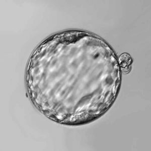 Stem Cells - blastocyst