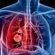 Treatment of COPD - Stem Cell Health - SG